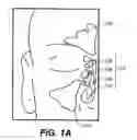 Fig. 02 - DEVICES AND METHODS FOR DELIVERING ACTIVE AGENTS TO THE OSTEOMEATAL COMPLEX