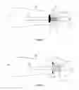 Fig. 02 - Devices for Handling Catheter Assembly