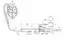Fig. 01 - Medical device