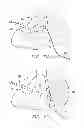 Fig. 06 - Radio frequency ablation cooling shield