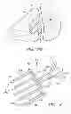 Fig. 08 - Radio frequency ablation cooling shield
