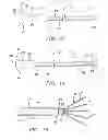 Fig. 11 - Radio frequency ablation cooling shield