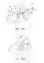 Fig. 12 - Radio frequency ablation cooling shield