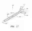 Fig. 13 - Radio frequency ablation cooling shield