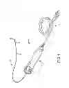 Fig. 02 - Electrode assembly for catheter system
