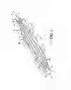 Fig. 04 - Electrode assembly for catheter system