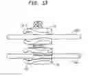 Fig. 08 - Fixation clamp
