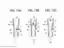Fig. 09 - Methods and devices for cutting and removing tissue from a body