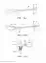 Fig. 07 - Apparatus and methods for removing vertebral bone and disc tissue