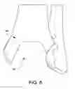 Fig. 09 - Orthopedic surgical guide