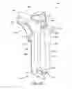 Fig. 49 - Orthopedic surgical guide
