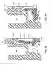 Fig. 52 - Orthopedic surgical guide