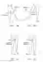 Fig. 02 - Apparatus and method for distracting the hip joint