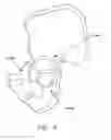 Fig. 06 - Apparatus and method for distracting the hip joint