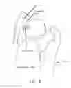 Fig. 09 - Apparatus and method for distracting the hip joint