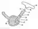 Fig. 01 - K-wire and method for surgical procedures