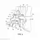 Fig. 06 - Orthopedic surgical guide