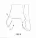 Fig. 09 - Orthopedic surgical guide