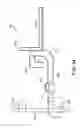 Fig. 31 - Orthopedic surgical guide