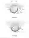 Fig. 23 - Tissue resecting systems and methods