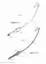 Fig. 04 - APPARATUS FOR SUBCUTANEOUS ELECTRODE INSERTION