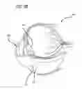 Fig. 06 - Real-time surgical reference indicium apparatus and methods for astigmatism correction
