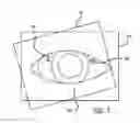Fig. 08 - Real-time surgical reference indicium apparatus and methods for astigmatism correction