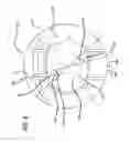 Fig. 09 - Real-time surgical reference indicium apparatus and methods for astigmatism correction