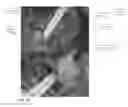 Fig. 14 - System and method for pelvic floor repair