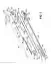 Fig. 05 - Surgical clip applicator