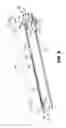 Fig. 06 - Surgical clip applicator
