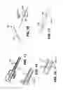 Fig. 08 - Surgical clip applicator