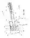 Fig. 113 - Inflatable medical devices
