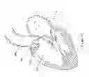 Fig. 131 - Inflatable medical devices