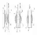 Fig. 133 - Inflatable medical devices
