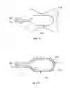 Fig. 20 - Inflatable medical devices