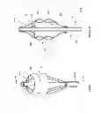 Fig. 28 - Inflatable medical devices