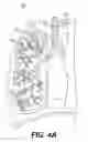 Fig. 04 - Devices for obstructing passage of air or other contaminants into a portion of a lung and methods of use