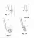 Fig. 02 - Embolus blood clot filter with bio-resorbable coated filter members
