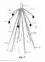 Fig. 03 - Embolus blood clot filter with bio-resorbable coated filter members