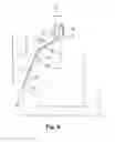 Fig. 10 - Embolus blood clot filter with bio-resorbable coated filter members
