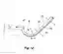 Fig. 13 - Embolus blood clot filter with bio-resorbable coated filter members