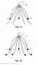 Fig. 14 - Embolus blood clot filter with bio-resorbable coated filter members