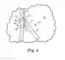 Fig. 05 - Tissue stabilization and repair device