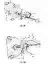 Fig. 08 - Devices, systems, and methods for suture management