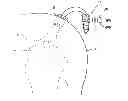 Fig. 01 - Suture anchor device, kit, and method