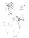 Fig. 02 - Suture anchor device, kit, and method