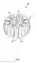 Fig. 07 - System and method for multiple level facet joint arthroplasty and fusion