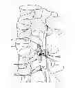 Fig. 01 - Bone clamping system