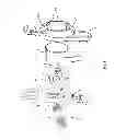 Fig. 02 - Bone clamping system